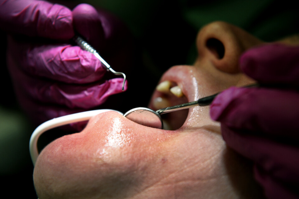 En tredjedel av de tänder som hade lagats med kompositfyllning direkt i munnen behövde lagas igen inom fem år. Arkivbild.