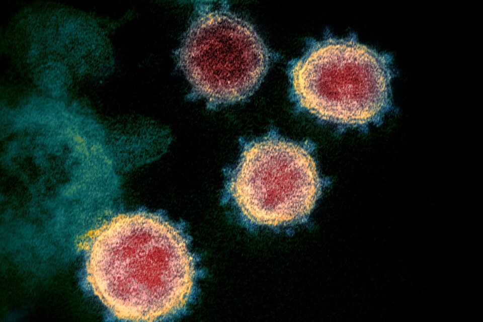 Viruset som orsakar covid-19, fotograferat med ett elektronmikroskop. Nu ska svenska forskare börja testa ett läkemedel, som i vanliga fall används i behandling av prostatacancer, mot covid-19.