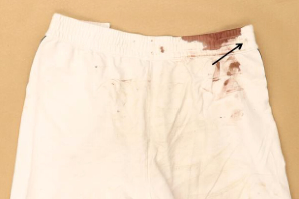 28-åringens shorts efter att han råkat skjuta sig själv.