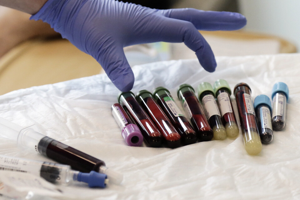 Patienter som får behandling med genmanipulerade celler följ regelbundet upp med bland annat blodprover. Arkivbild.