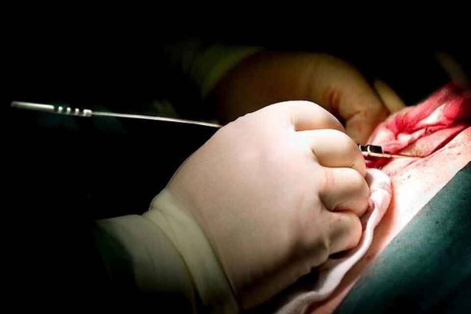 Den tunna vajern med elektroder förs in genom nålen till hålrummet längs ryggraden, epiduralrummet.