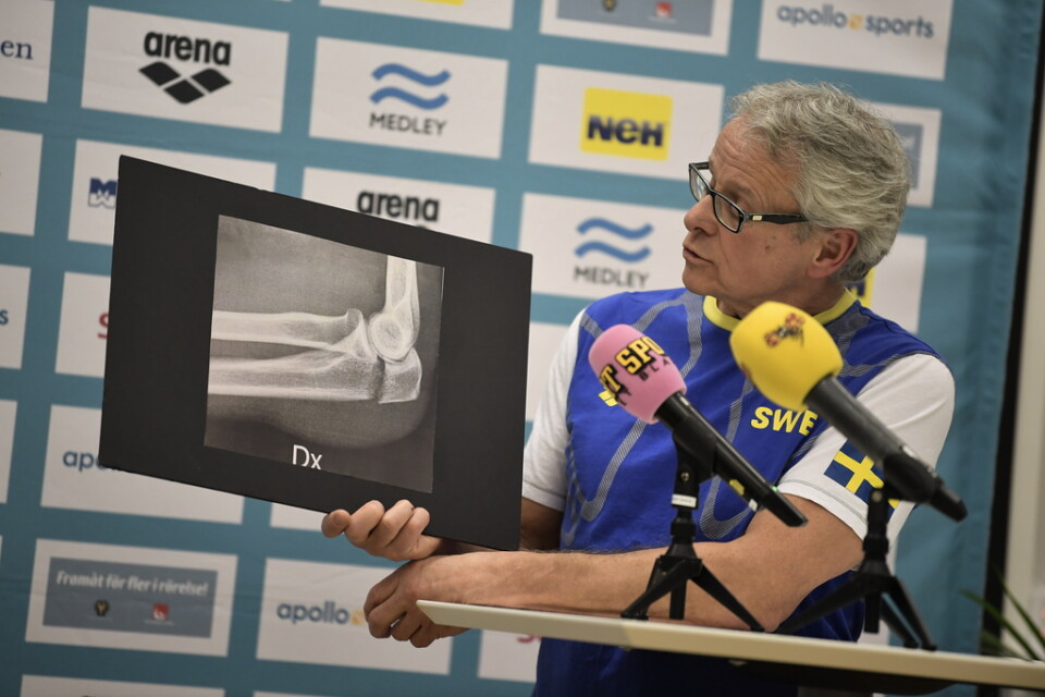 Simningens landslagsläkare René Tour på en tidigare presskonferens med röntgenbilden på Sarah Sjöströms högra armbåge. Arkivbild.