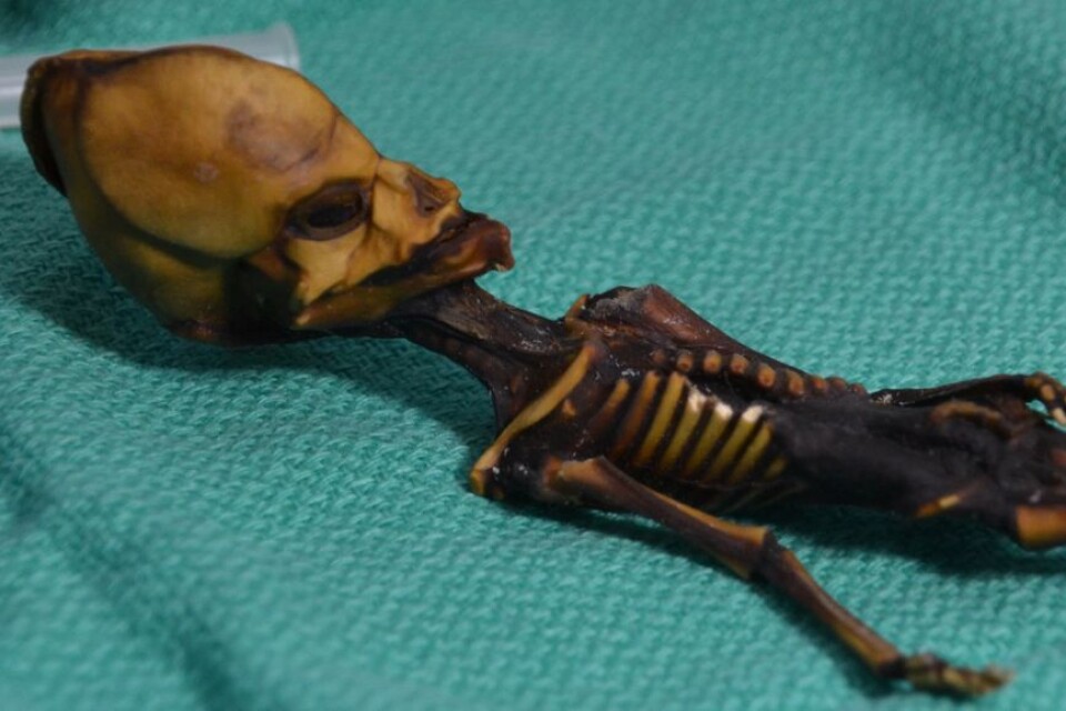 Det utomjordingliknande skelettet från Atacamöknen i Chile tillhörde ett litet flickfoster med sällsynta genmutationer kopplade till dvärgväxt och förtida åldrande, visar analysen från universitetet i Stanford.