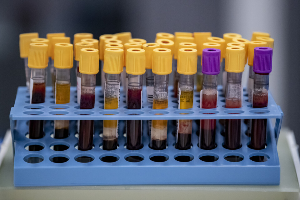Blodprover som ska analyseras för covid-19 antikroppar på Klinisk mikrobiologi i Lund. Region Skåne är en av 14 regioner som erbjuder allmänna antikroppstest. Arkivbild.