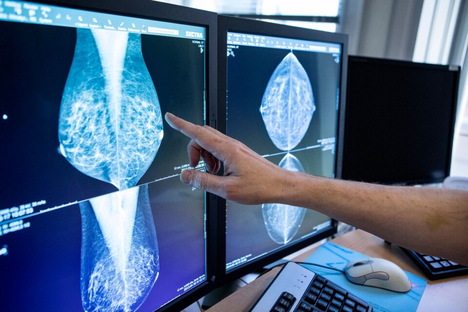 Var det osäkert om din fot var bruten? Hade ditt barn lunginflammation? Har du råkat ut för diskbråck eller gjort mammografi? Varje år utförs cirka 5,5 miljoner röntgenundersökningar i Sverige.