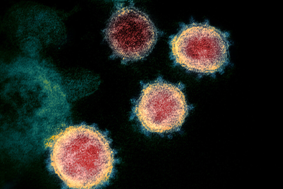 Coronaviruset sars-cov-2, sett genom mikroskop. Arkivbild.