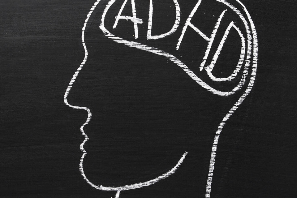 Medicinering med metylfenidat vid adhd tycks påverka hjärnans vita substans.