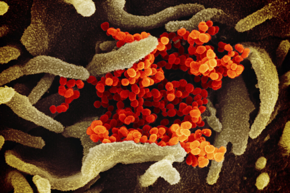 I provrörsförsök har det nya coronaviruset visat sig sårbart för klorokin, den verksamma substansen i malarialäkemedel. Men försök på människor visar risk för allvarliga biverkningar. Arkivbild.