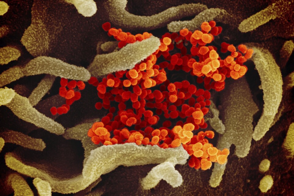 Viruset orsakar covid-19, en luftvägssjukdom som i de flesta fall ger milda symtom, men som också kan orsaka svår sjukdom och vara dödlig.