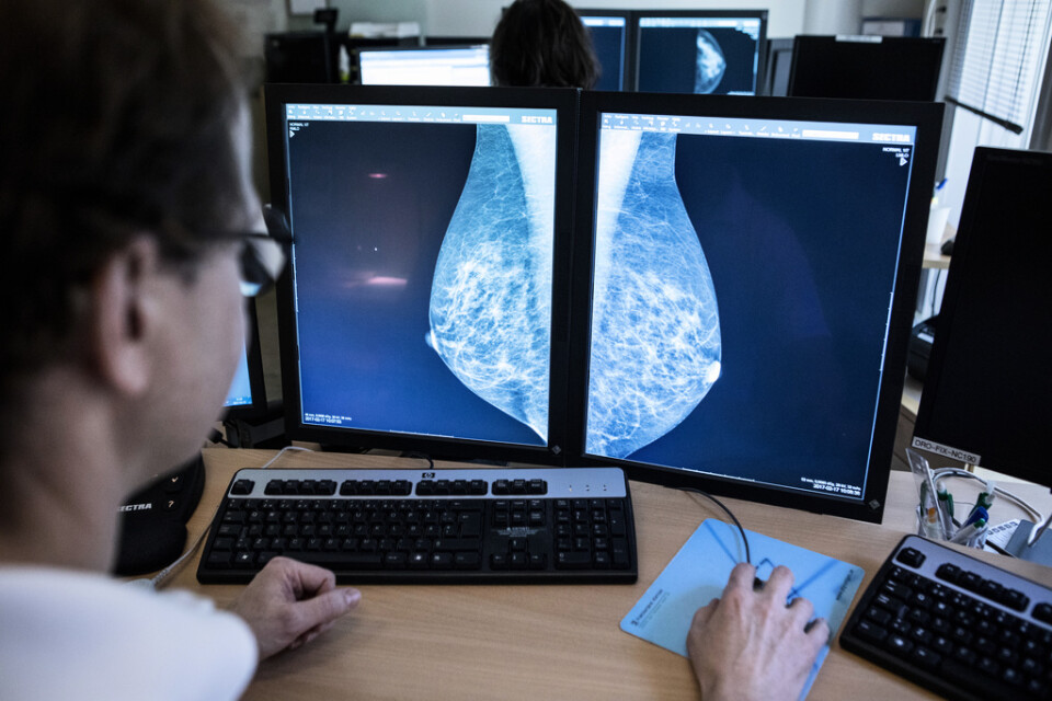 Screening som bland annat mammografi har bidragit till att fler fall av cancer upptäcks och behandlas. Arkivbild.