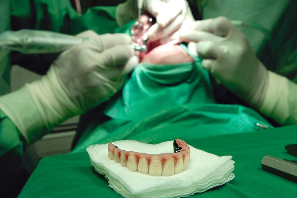 Nästan var sjätte person som fått tandimplantat drabbas av en allvarlig inflammation i angränsande vävnader, peri-implantit. Det visar en studie vid Sahlgrenska akademin i Göteborg. Studien omfattar 4 716 personer som fick tandimplantat 2003-2004. Nio å