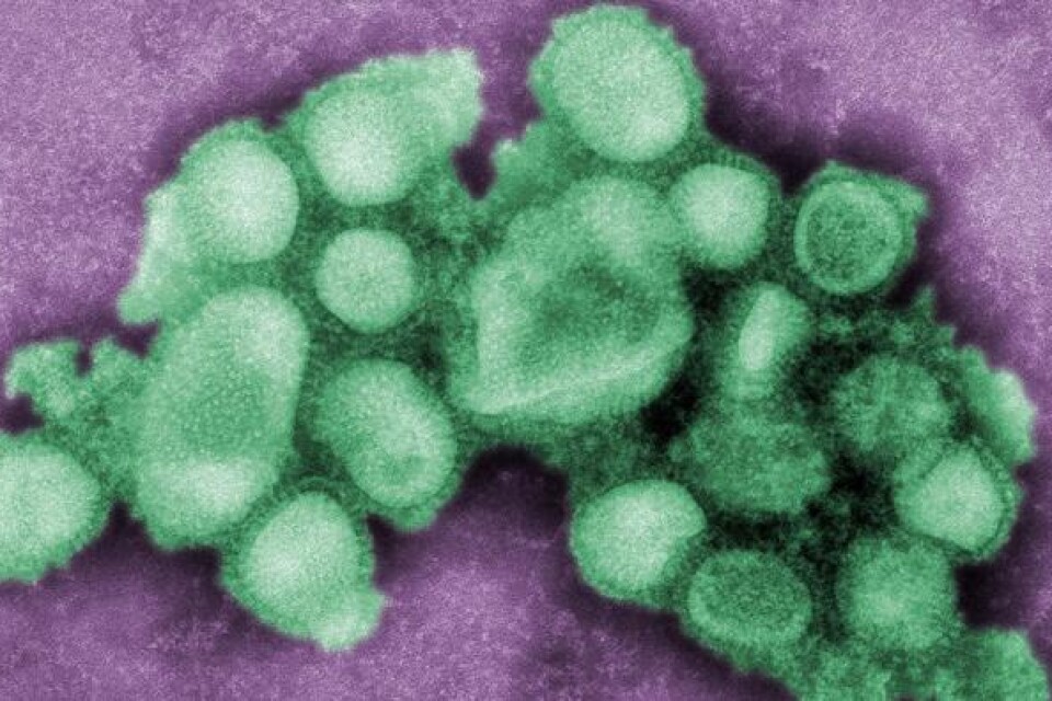Mikroskopbild på svininfluensaviruset.