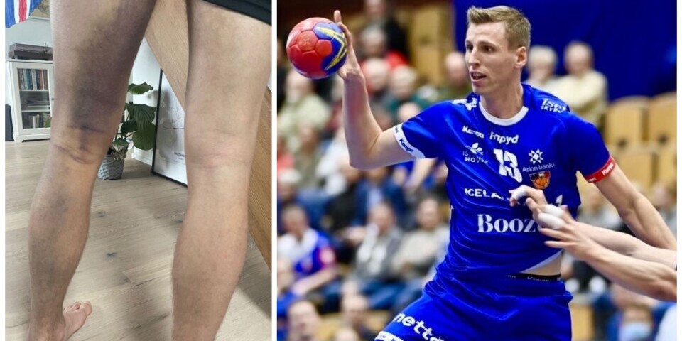 Förre IFK-stjärnan om bilderna: ”Blåste upp som ballong”