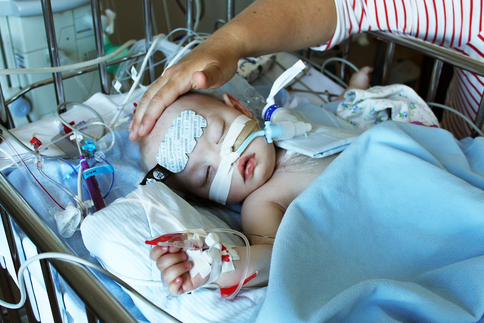 Tolv timmar efter operationen där läkarna på Drottning Silvias barnsjukhus slöt det hål mellan hjärtats kamrar som Elise hade fötts med.