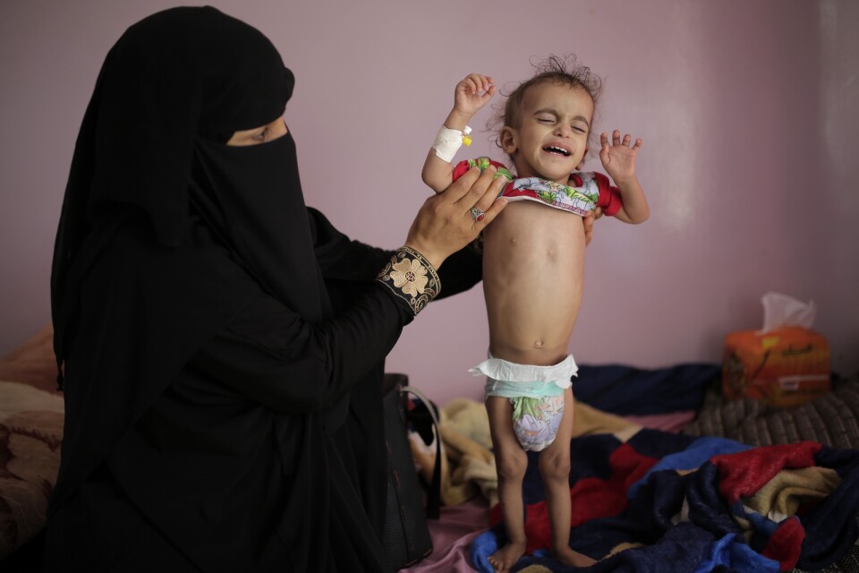 En kvinna i Jemen håller upp sin undernärda son. Arkivbild