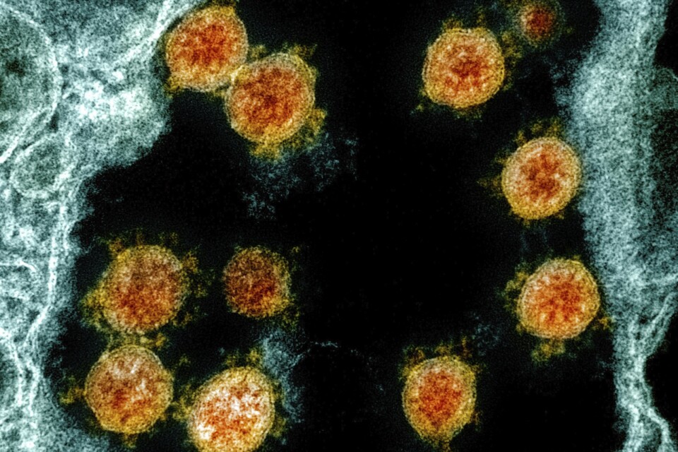 Jakten fortsätter på ett vaccin mot det nya coronaviruset sars-cov-2. Arkivbild.
